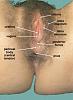 Click image for larger version. 

Name:	femaleperineumliving.jpg 
Views:	39 
Size:	33.9 KB 
ID:	21543